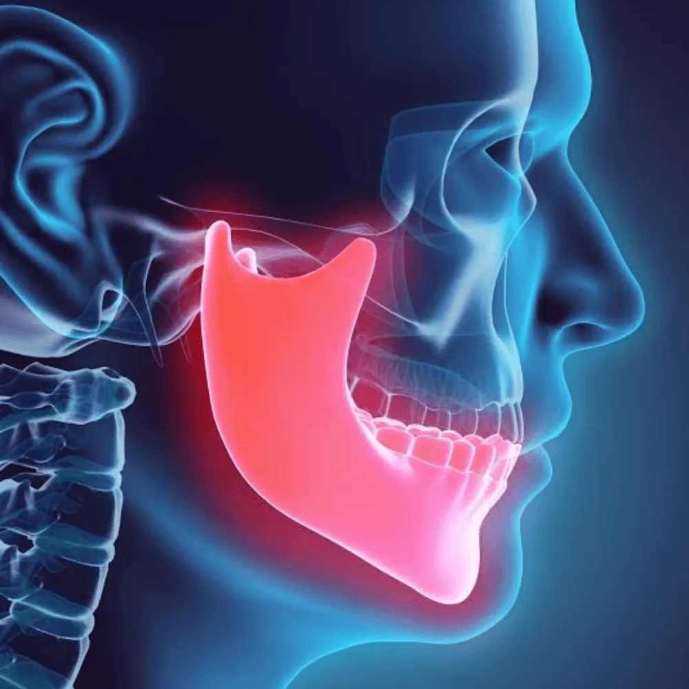 Cirurgia da ATM